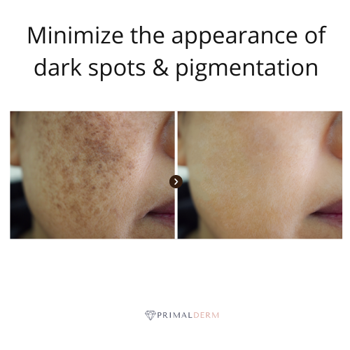 Folliqa LED Face Therapy Mask