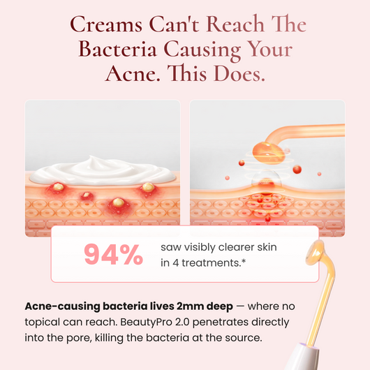 BeautyPro 2.0 - High Frequency Wand
