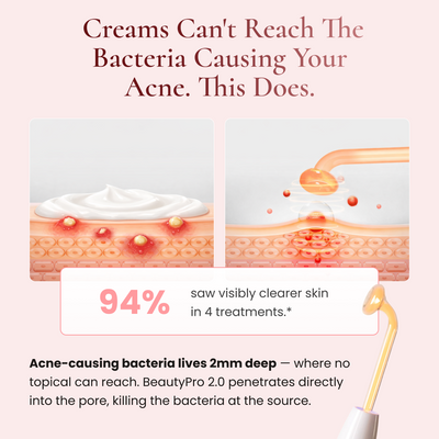 BeautyPro 2.0 - High Frequency Wand