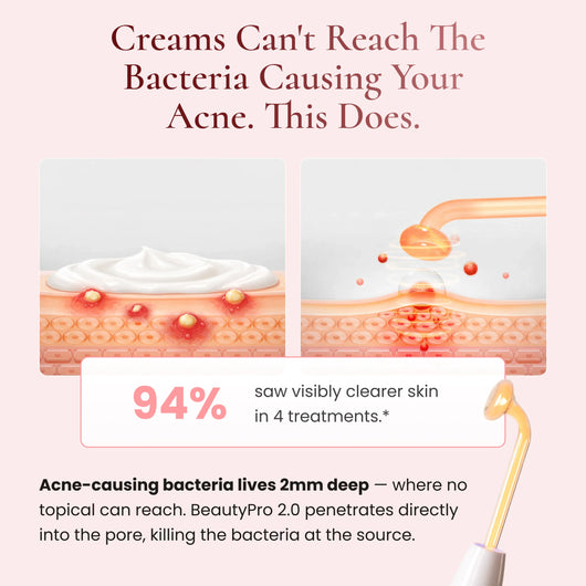 BeautyPro 2.0 - High Frequency Wand