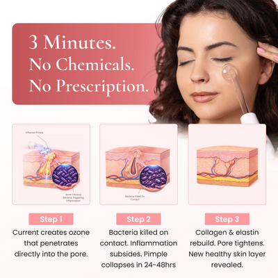 BeautyPro 2.0 - High Frequency Wand
