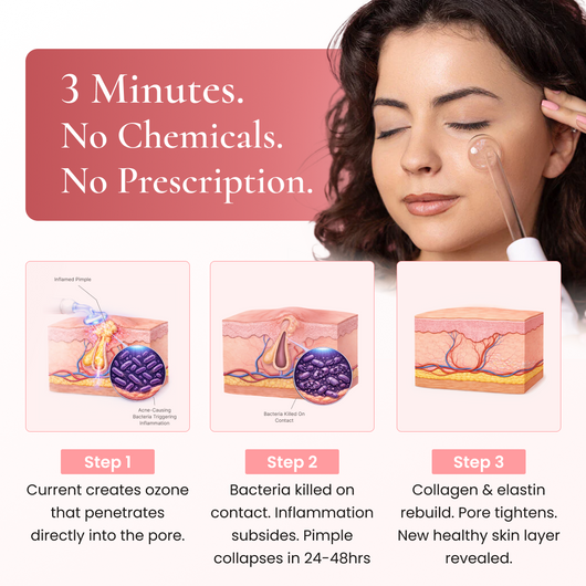 BeautyPro 2.0 - High Frequency Wand