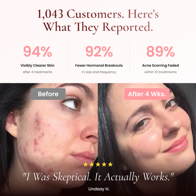 BeautyPro 2.0 - High Frequency Wand