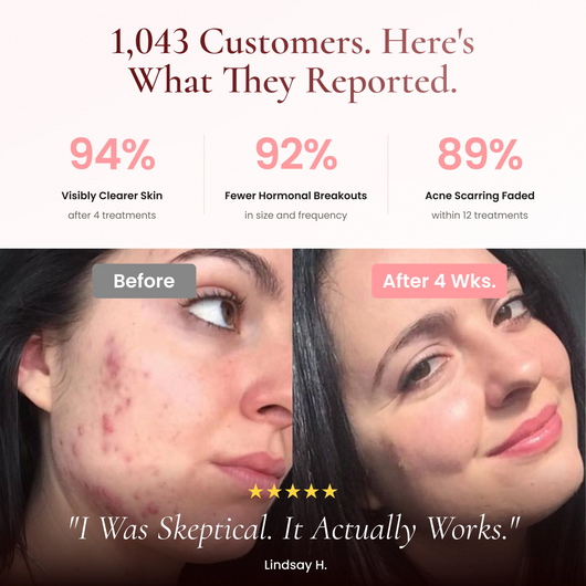 BeautyPro 2.0 - High Frequency Wand