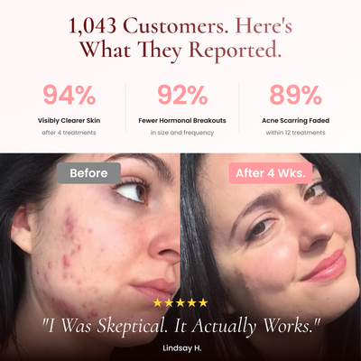 BeautyPro 2.0 - High Frequency Wand