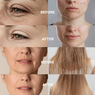 High Frequency Therapy 4-in-1 Set |